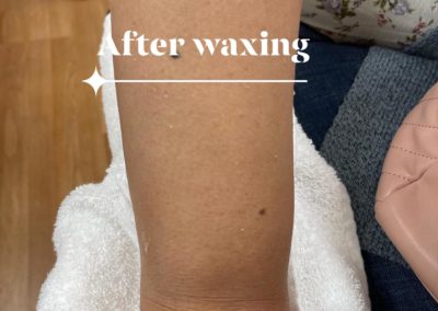 after waxing results Image 53
