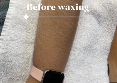 before waxing results Image 50