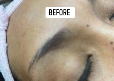before eyebrowthreading results Image 43