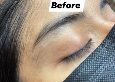 before eyebrowthreading results Image 39