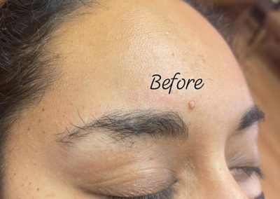 before eyebrowthreading results Image 36