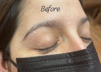 before eyebrowthreading results Image 33