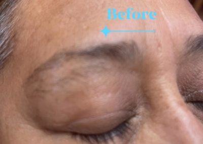 before eyebrowthreading results Image 26