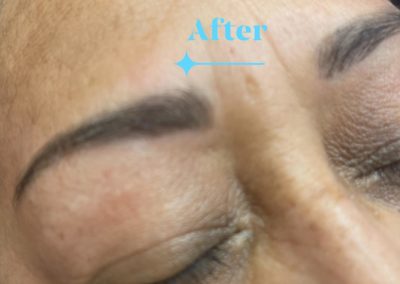 after eyebrowthreading results Image 23