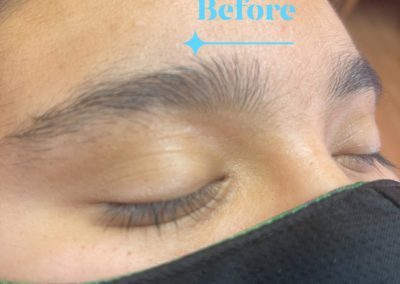 before eyebrowthreading results Image 21