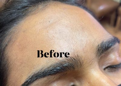 before eyebrowthreading results Image 18