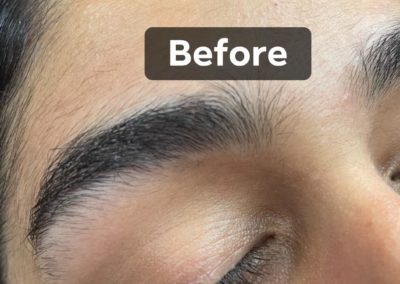 before eyebrowthreading results Image 16