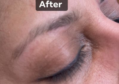 after eyebrowthreading results Image 13
