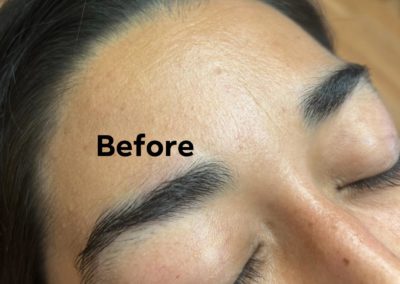before eyebrowthreading results Image 10