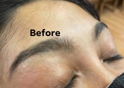 before eyebrowthreading results Image 8