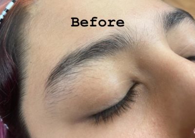 before eyebrowthreading results Image 3