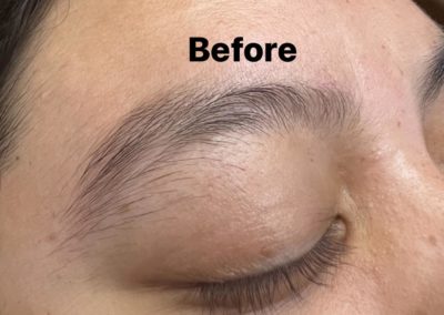 before eyebrowthreading results Image 1